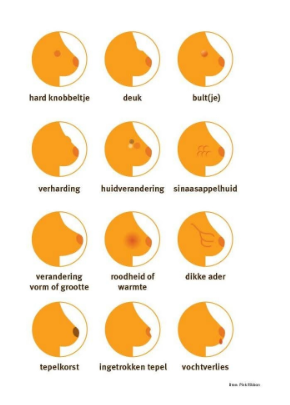 Borstkankercheck